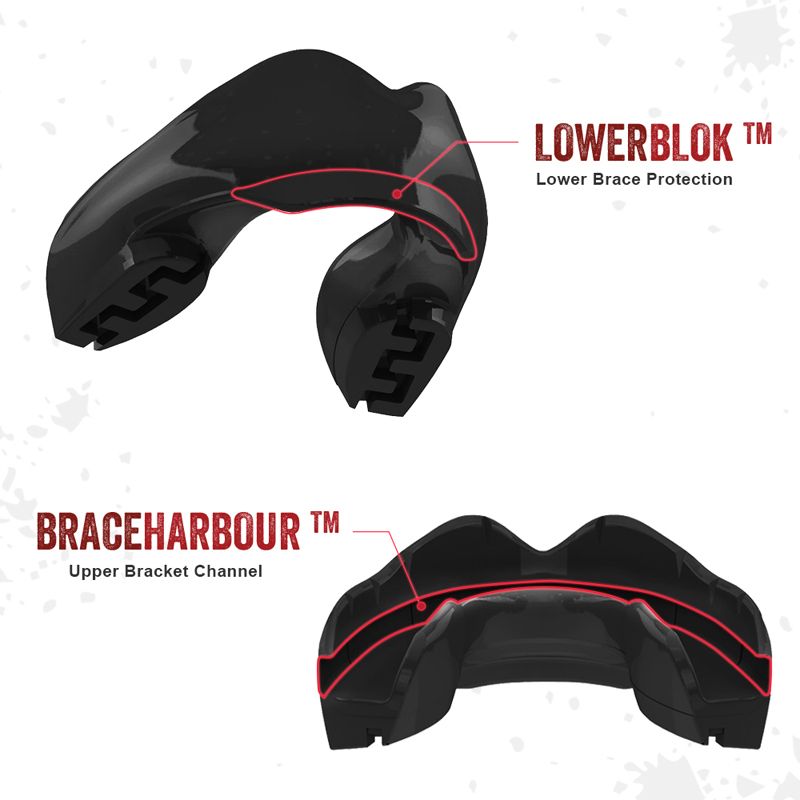 Safejawz Bitje Voor Beugel - Zwart - Gebitsbeschermers